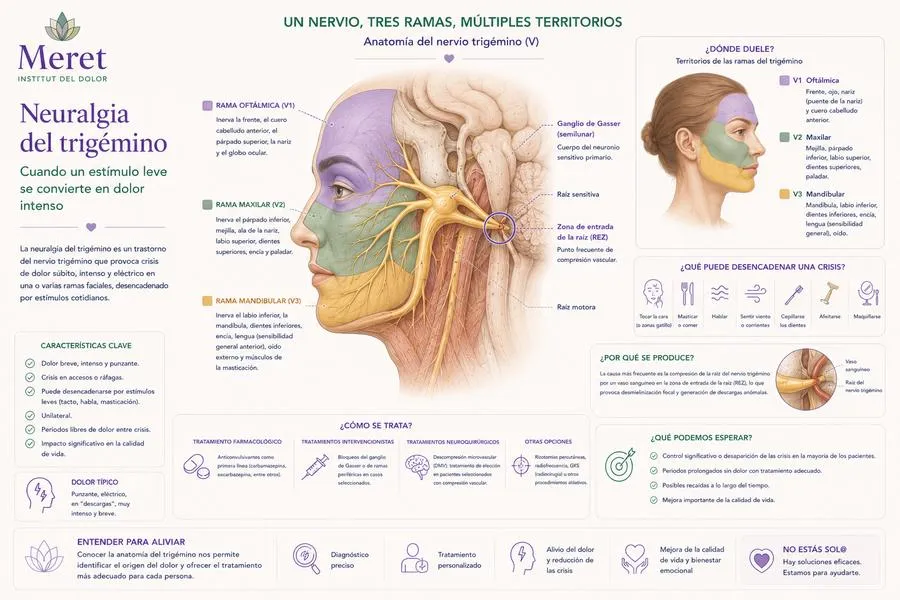 Neuralgia del trigémino