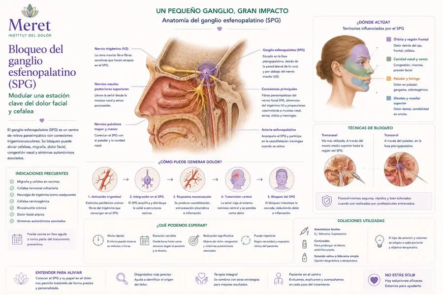 Bloqueo del ganglio esfenopalatino